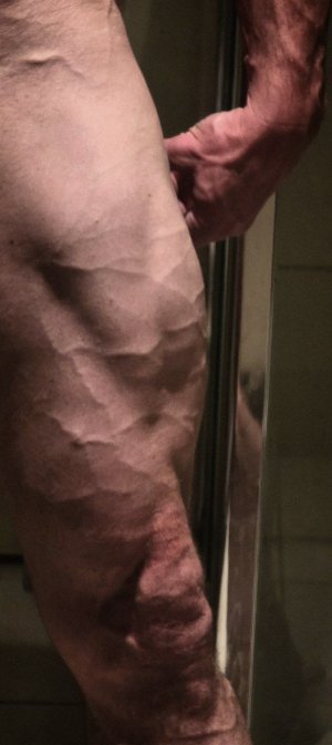 IMG_20251125_060536_508.jpg IMG_20251125_060536_508.jpg